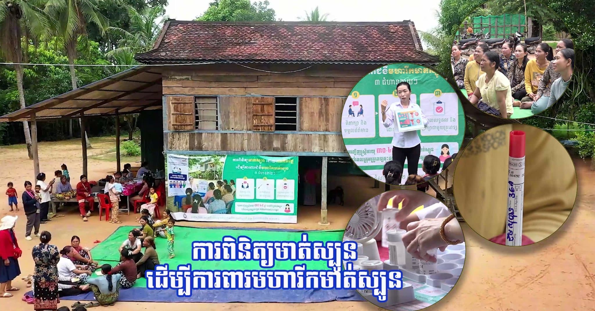 វីដេអូ៖ ដើម្បីចូលរួមចំណែកការពារ និងលើកកម្ពស់សុខភាពជូនបងប្អូនប្រជាពលរដ្ឋក្នុងមូលដ្ឋាន ក្រុមការងារមណ្ឌលសុខភាព បាគង បានផ្ដល់ «ការពិនិត្យស្វែងរកជំងឺមហារីកមាត់ស្បូន ដោយឥតគិតថ្លៃ» ជូនដល់បងប្អូនស្ត្រី ដែលរស់នៅក្នុងភូមិស្ទឹង ឃុំបាគង ស្រុកប្រាសាទបាគង ខេត្តសៀមរាប។